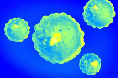 MBD_AIVirus_SM_08072026