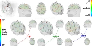 brainonllm-6855906ee3980-scaled