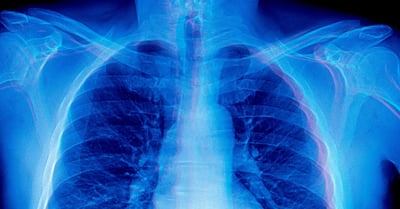 frontier-models-medical-advice-x-rays-cant-see